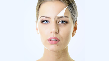 chemical skin peels